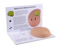 Genérico Maniquíes de modelo de seno de silicona del cuerpo humano,Modelo anatómico de mama con cáncer,Maniquíes de autoprueba de mama de bultos patológicos, comunicación médico-paciente