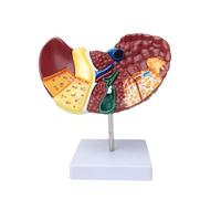 Genérico Modelo anatómico del hígado Humano, Modelo anatómico del hígado de la patología del tamaño Natural, Modelo patológico de la cirrosis del hígado de Las características para el Estudio