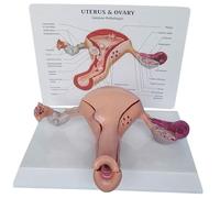 Genérico Modelo Anatomico Vagina Ovario Utero, Montaje Modelo Utero Humano, Modelo Patologias Ovarios y Utero