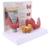 Genérico Modelo de Anatomía de Tiroides, Modelo de Enfermedades de la Tiroides Humana con Tarjeta de Instrucciones, 3:1 Mostrando el Sistema Digestivo Patológico de la Tiroides