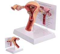 Genérico Modelo de anatomía del útero femenino y órganos reproductores, modelo anatómico patológico del útero y los ovarios para enseñanza de anatomía médica en escuelas y hospitales
