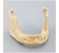 Genérico Modelo De Implante Mandibular, Práctica De Sutura Gingival, Simulación De Hueso Esponjoso, Demostración De Enseñanza Dental, Entrenamiento En Perforación E Injerto óseo (A)