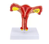 Genérico Modelo de ovario femenino - Modelo de útero y ovario humano de tamaño natural Modelo de órgano reproductor femenino para el estudio y la comunicación