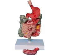 Genérico Modelo de Patología del Intestino Grueso, Modelo de Anatomía del Estómago Humano - Modelo Patológico del Sistema Digestivo, Modelo de Enseñanza Removible, Anatomía del Modelo Médico