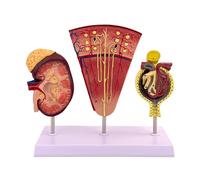 Genérico Modelo de riñón humano, 3 partes agrandar Nefrona Glomérula Estructura renal Modelo de anatomía con tarjeta de manual de producto base para educación médica Urólogos Consulta