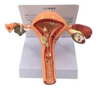 Genérico Modelo de Útero Patológico - Modelo Anatómico del Sistema Reproductor Femenino, Modelo de Anatomía del Útero y Ovarios - para Educación en Anatomía y Fisiología Humana