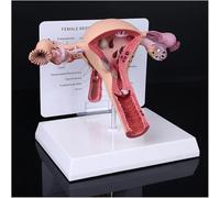Genérico Modelo patológico de ovario uterino, modelo anatómico de útero humano modelo anatómico de útero humano con tarjeta de visualización educativa y base para la enseñanza escolar
