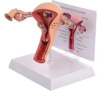 Genérico Sistema Reproductivo Femenino Modelo Útero Humano Modelo 3D Útero Ovario, Sistema Reproductivo Femenino, Enseñanza Aprendizaje, Herramienta de Visualización Modelo Anatómico