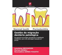 Gestão da migração dentária patológica: Da perda de ancoragem periodontal à reabilitação ortodôntica: para uma abordagem baseada em provas