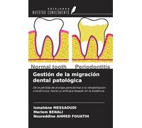 Gestión de la migración dental patológica: De la pérdida de anclaje periodontal a la rehabilitación ortodóncica: hacia un enfoque basado en la evidencia