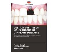 GESTION DES TISSUS MOUS AUTOUR DE L'IMPLANT DENTAIRE: Gestion d'un biotype gingival mince en tant que procédure pré-implantaire