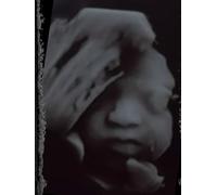 Gianna Ultrasound Book- Scrap Book