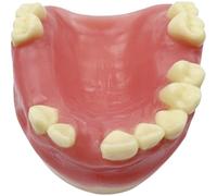 Glixoft Modelo De Práctica De Implantes Dentales con Encías Suaves, Modelo De Dientes Orales, Modelo De Anatomía Dental, Ayuda Educativa Médica para Enseñanza Dental