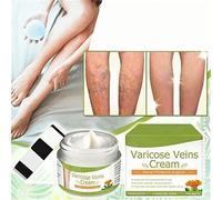 Gokame Varicose Veins Cream for Legs, Spider Leg Repair Cream, Crema para Varices, Crema para venas varicosas, Quick Effective to Relieve Pain of Legs (2pcs)