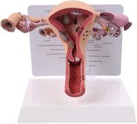 GPDNBIEU, Modelo de patología del útero femenino humano, enfermedad ovario, disección biología, ayuda for enseñanza, anatomía, lesión