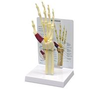 GPI Anatomicals Modelo de síndrome de túnel carpiano mano/muñeca