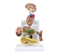 GPI Anatomicals Modelo de síndrome metabólico