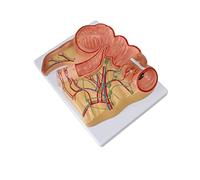 GTHTUHFD Modelo Educativo De Apendicitis Rectal Humana, Modelo De Distribución De Ganglios Linfáticos para Estudio Médico, Material Didáctico, Demostración De Comunicación Mé