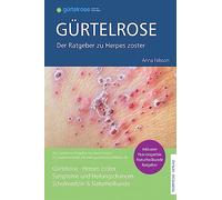 Gürtelrose - Der große Ratgeber zu Herpes zoster: Schulmedizin + Naturheilkunde