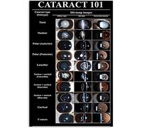 Guía básica sobre cataratas, póster metálico de oftalmología, decoración para consultorio de oftalmólogo, hogar, clínica, habitación, hospital oftalmológico, arte mural, 8x12 pulgadas