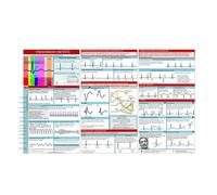 Guía de bolsillo ECG, tarjeta de bolsillo ECG, interpretación del ritmo de ECG, tarjeta de referencia compacta y portátil de doble cara, tarjetas flash para paramédicos, guía de enfermería de bolsillo