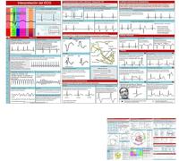 Guía de bolsillo EKG, interpretación del ritmo de ECG, tarjeta de referencia portátil compacta de doble cara, guía de enfermería de bolsillo de ECG de interpretación rápida, tarjetas de memoria