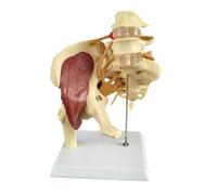 Half Hip Joint Teaching Model with Muscle, Nerve, Pelvic Bone, Spine & Intervertebral Disc Protrusion