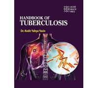 Handbook of Tuberculosis