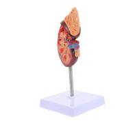 HEALSOPTHY De Riñón Base para Estudio y Educación Médica Anatomía Detallada y Removible para Demostraciones Clínicas
