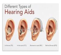 Hearing Aids Educational Poster Types and Information Metal Tin Sign Wall Art for Home Decor(Framed,12x18inch(30x45cm))