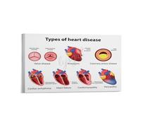 Heart Attack and Disease Warning Signs Poster Cardiovascular Health Education Chart for Medical Office Clinic Hospital Gym Wall Art Decor(Unframed,08x12inch(20x30cm))