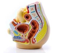 Hernia abdominal, modelo de hernia inguinal, anatomía del saco herniario, modelo de demostración de hernia inguinal humana, for aprendizaje de formación médica