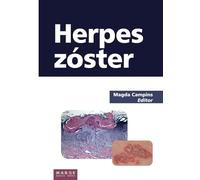 Herpes zóster (Medicina y Ciencias de la Salud)