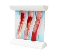Herramienta de educación médica profesional con estructura de vasos sanguíneos resíticos y modelo de trombosis de placa arterial de demostración dinámica interactiva