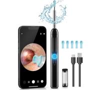 Herramienta de eliminación de cera de oído, alcance HD 1296P y 6 luces LED, limpiador de oídos con cámara, kit de limpieza de oídos, herramienta de eliminación de cerumen con 10 cucharas (ónix)