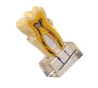 Herramienta de entrenamiento de dientes portátil U6X modelo de anatomía y dientes transparentes ampliados para aula y ajuste clínico, modelo de enseñanza para estudiantes