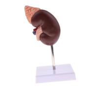 Herramienta Educativa de Anatomía del Modelo de Riñón para Enseñanza Médica y Cursos de Salud, 24 Marcadores, PVC Respetuoso con el Medio Ambiente