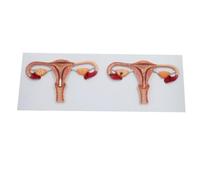 Herramientas Didácticas Modelo de Anatomía del Óvulo Femenino - Modelo Ampliado del Proceso de Fertilización del Óvulo Femenino - Material Didáctico para Ginecología Color Carne 90 Cm