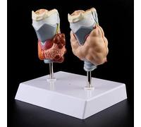 Herramientas para Modelos didácticos, Modelo patológico de tiroides, hipertiroidismo, hipotiroidismo, Sistema endocrino Humano, anatomía médica, Modelo de lesión de tiroides, enseñ