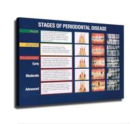 HGETJOHXEM Gum Disease Stages Periodontal Progression Chart Anatomy Educational Poster for Oral Health Hygiene Students Professionals Office Decor(Unframed,08x12inch(20x30cm))