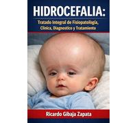 Hidrocefalia: Tratado Integral de Fisiopatología, Clínica, Diagnóstico y Tratamiento