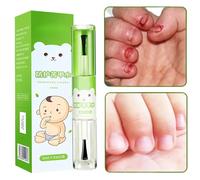 Hiemible Anti mordeduras de uñas, agua anti -mordedura de uñas | 10 ml Stop Thumb Sucking para niños,Safe evita que los hábitos de succión de los dedos para el jardín de infantes de jardín de infantes