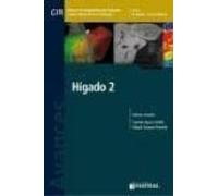 Higado 2: Avances En Diagnostico Por Imagenes 16