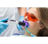 -Higiene dental con pulido diagnostico con ultrasonido y revisión con radiograf