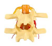 Hilitand Modelo de Demostración de Hernia Discal Lumbar Humano Columna Vertebral Humana Médica para Estudio, Modelo Anatómico de Demostración, Tamaño 1: 1,5, Default