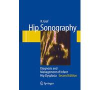 Hip Sonography: Diagnosis and Management of Infant Hip Dysplasia