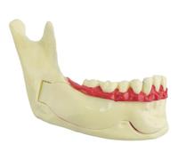 HiyyFloy Modelo De Tratamiento De Endodoncia Dental, Modelo Anatómico De Tejido Mandibular, Anatomía De Encías, Modelo De Dientes, Modelo De Enseñanza De Dientes