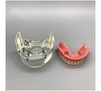 HOMEDAI Modelo Dental Dental Dental, implantación Dental - 2 Plantas mandibulares más Bajas para enseñar y estudiar Modelo de restauración de Dientes