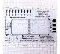 HOMEECG Regla de 7 pasos, regla de ECG, regla de plástico, herramienta de medición para interpretación de ECG/ECG, herramienta de medición transparente para estudiantes de medicina de enfermería (2