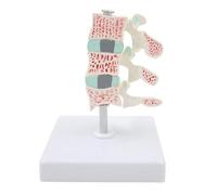 HUIBBGO Modelo anatómico de la Columna Cervical, Modelo anatómico de los Huesos y articulaciones de la Columna Vertebral Humana, Modelo de lesión osteoporótica para Estudio científico y en